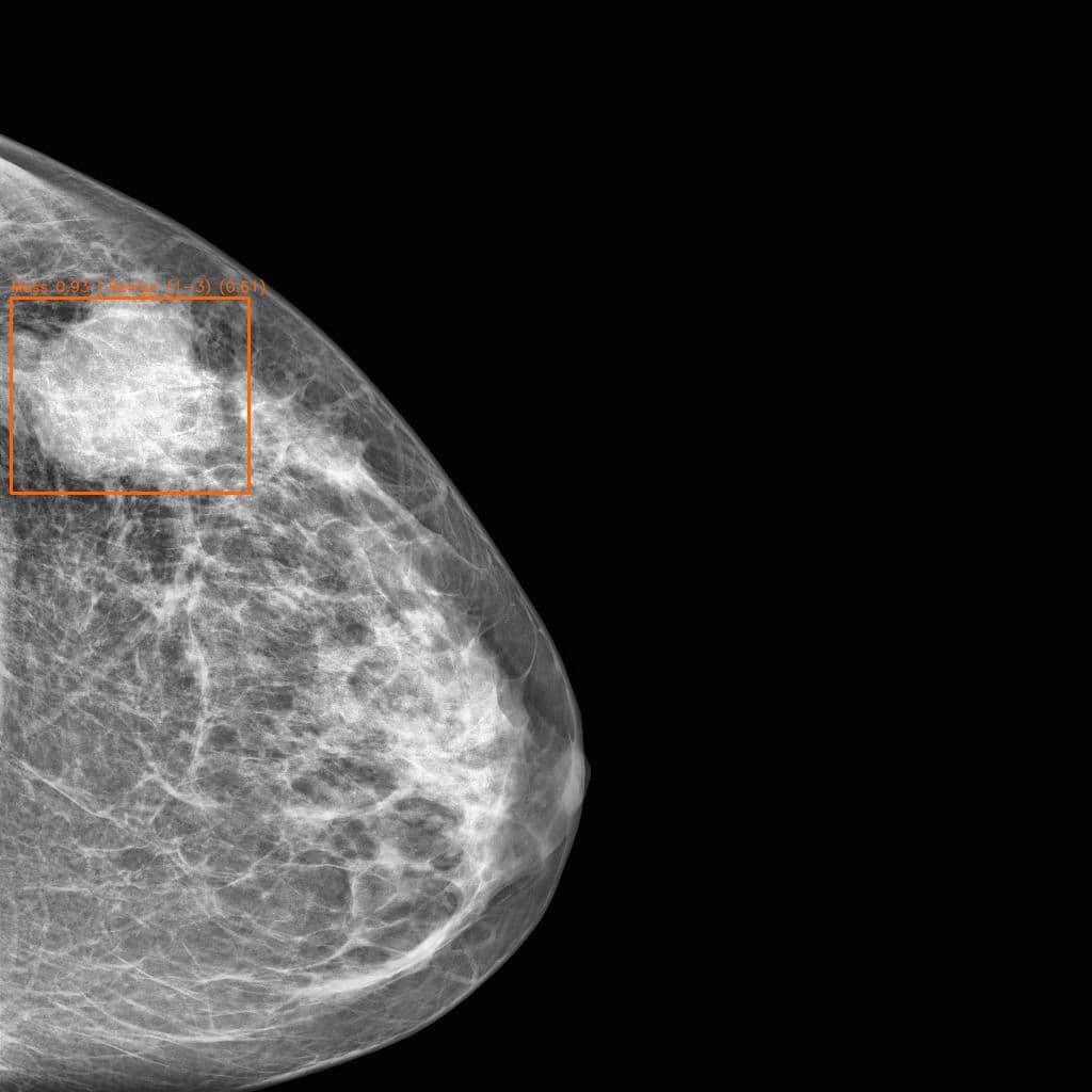 Radiologist analyzing medical imaging